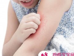 爸妈最想问过敏气喘科医师的8件事