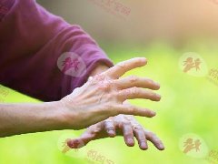 翘二郎腿会造成骨盆歪掉是迷思 专家揭腰酸背痛的真正原因和修复方式