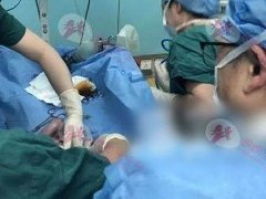 早产婴呼吸停止 父亲忍痛放弃救治