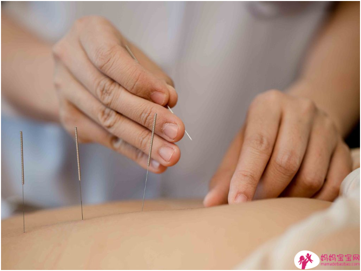 孕期针灸可以尝试吗？ 8个问题让你了解针灸的厉害