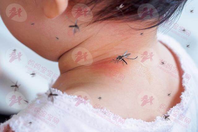 宝宝几个月可以用驱蚊剂？宝宝被蚊虫叮咬后怎么办？