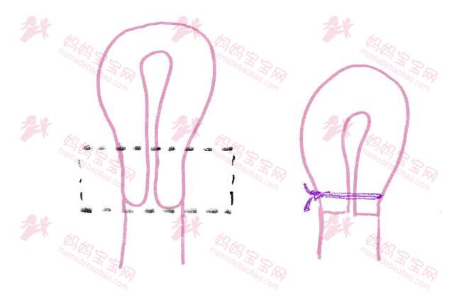 曾经罹患子宫颈癌,如今好不容易怀孕,但是家人怕她有危险 ...