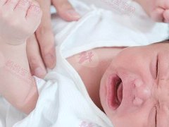 满月新生儿黄疸仍未消退医通过这一点揪出胆道闭锁症