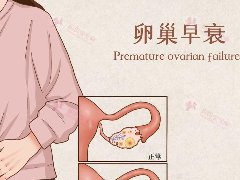 30岁卵巢早衰的现象有哪些？