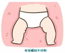 宝宝腿纹不对称 可以这样做