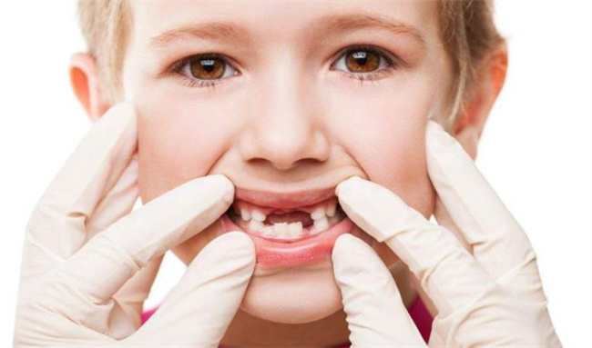 孩子出现蛀牙可以做根管治疗吗 应该注意什么