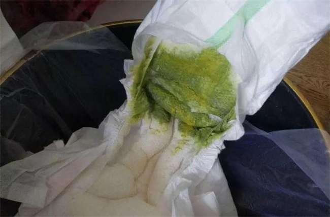 孩子拉的粑粑发绿是怎么回事（生理原因和病理原因）