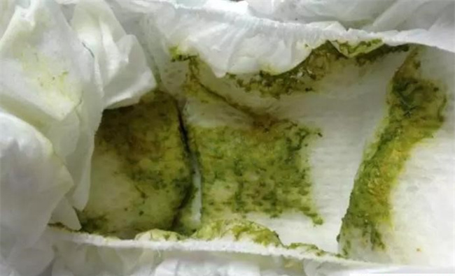 孩子拉的粑粑发绿是怎么回事（生理原因和病理原因）