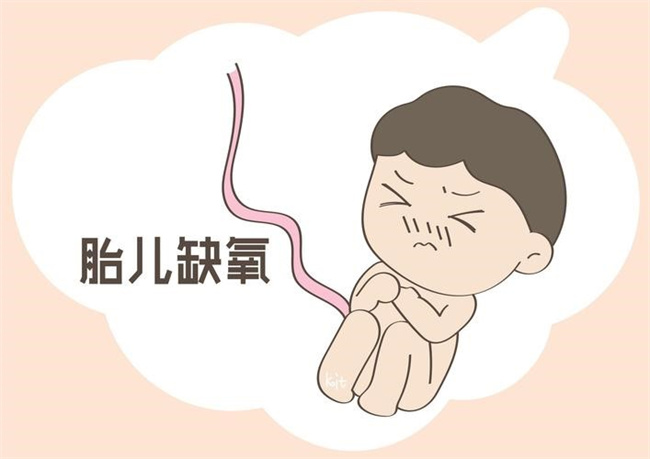 孕妇缺氧会导致肚子里的胎儿缺氧吗（会）