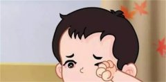 宝宝过敏性结膜炎是什么原因导致的（过敏体质）