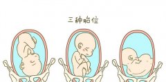 胎位不正孕妇需要注意哪些事项（定期产检，按照医生的指导操作，保持良好的