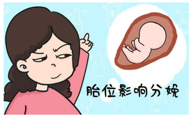胎位不正孕妇需要注意哪些事项（定期产检，按照医生的指导操作，保持良好的