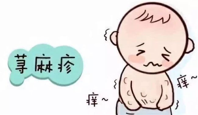 小儿荨麻疹急性和慢性的用药方法及偏方（口服药物或擦拭身体）