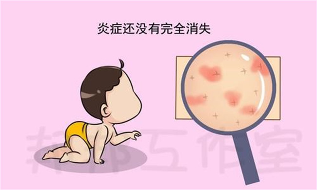 宝宝湿疹类型有哪些，湿疹该如何治疗（5种类型，及时就医）