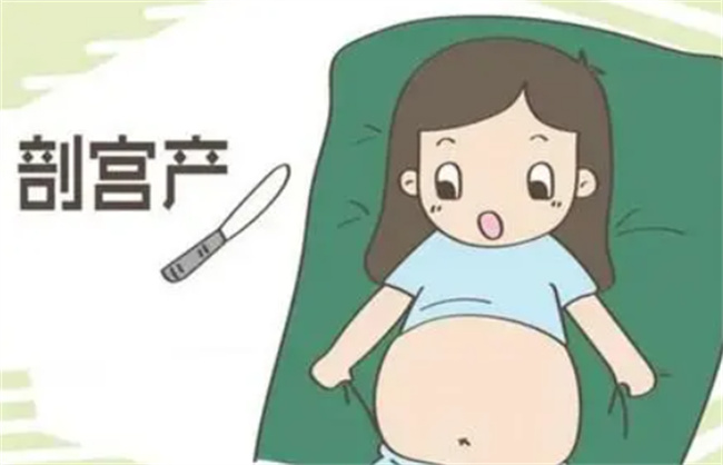 必须进行剖腹产的14个指标