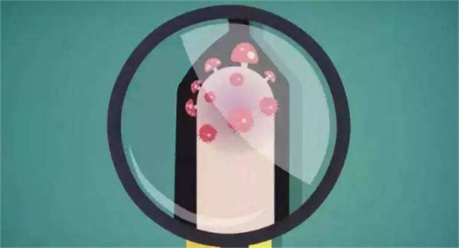 龟头炎应该怎样治疗