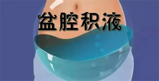 女性盆腔积液有哪些症状