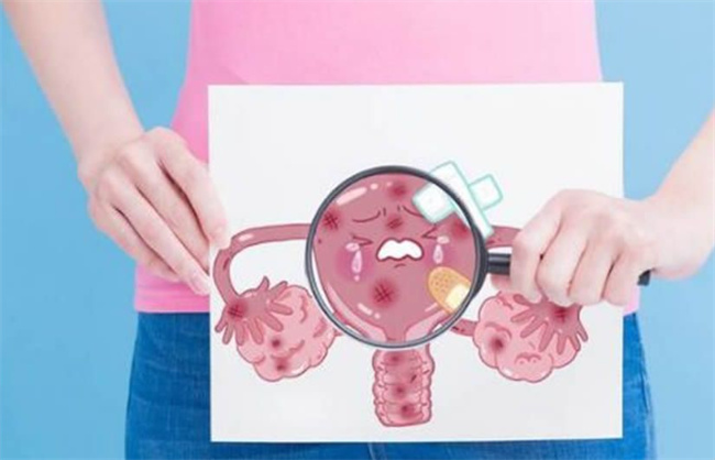 女性盆腔积液有哪些症状