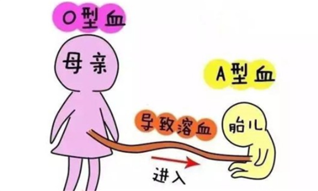 新生儿abo溶血症有哪些治疗方法