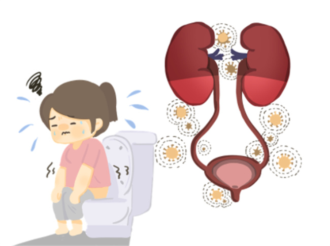 引起女性泌尿系炎症的原因