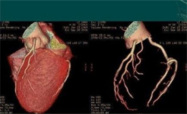 心慌心悸应该做哪些检查