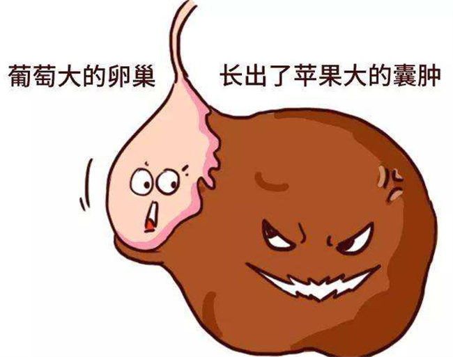 巧克力囊肿的症状大全