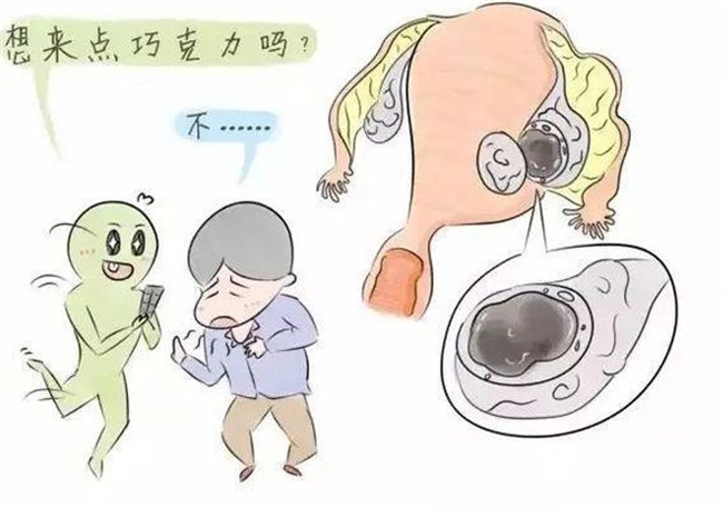 巧克力囊肿的症状大全