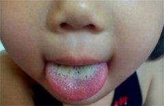 宝宝舌苔厚白的食疗方法