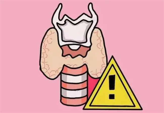 甲亢有哪些早期症状