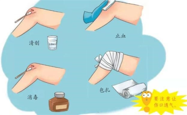 处理伤口正确的方法