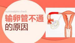 探究导致输卵管不通的常见原因