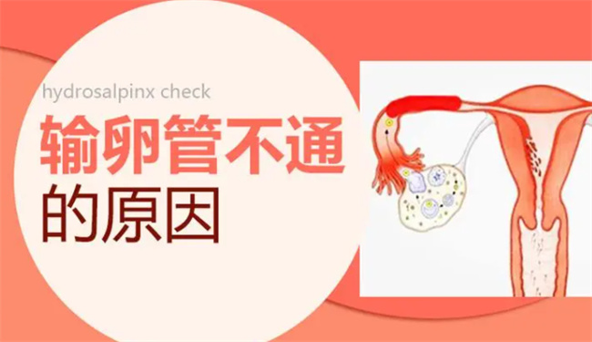 探究导致输卵管不通的常见原因