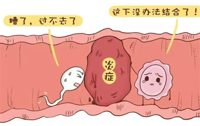 探究导致输卵管不通的常见原因