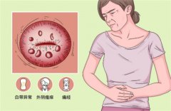 揭示宫颈囊肿发病的根本原因：探索成因与相关因素