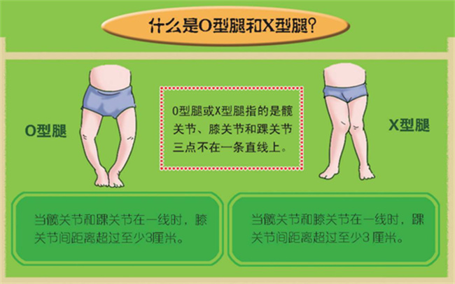 婴儿罗圈腿的症状和原因