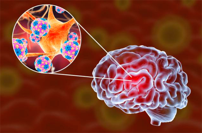 儿童脑膜炎不及时治疗会痴呆吗