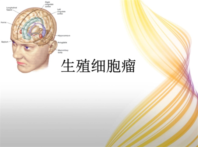 哪些症状可以检测出儿童生殖细胞肿瘤