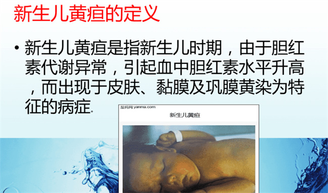 新生儿黄疸的原因是什么