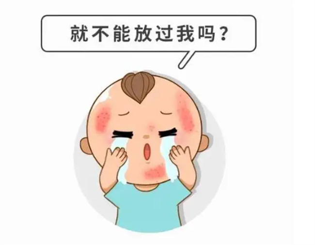 怎么样才能预防儿童皮疹