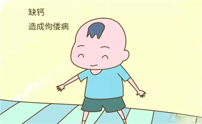 佝偻病对孩子的成长又怎么样的影响