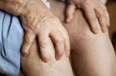 痛风症状解析：无症状期、急性关节炎期和痛风石及慢性关节炎期