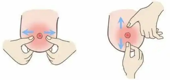 揭秘乳头内陷：原因与解决方法解析