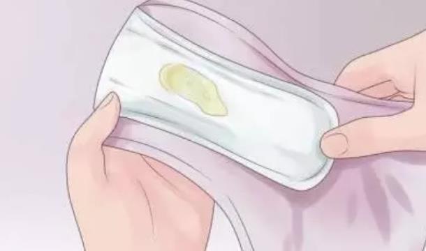 女性白带中出现血丝的原因及注意事项