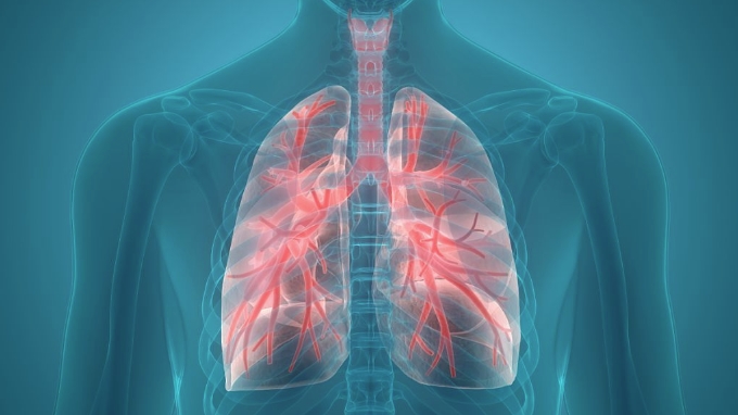 支气管扩张的治愈与护理