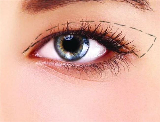 选择明智，双眼皮修复手术如何在专业医院中找到信心保证