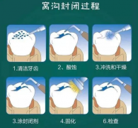 价格、材质与持久性，孩子需注意的关键细节