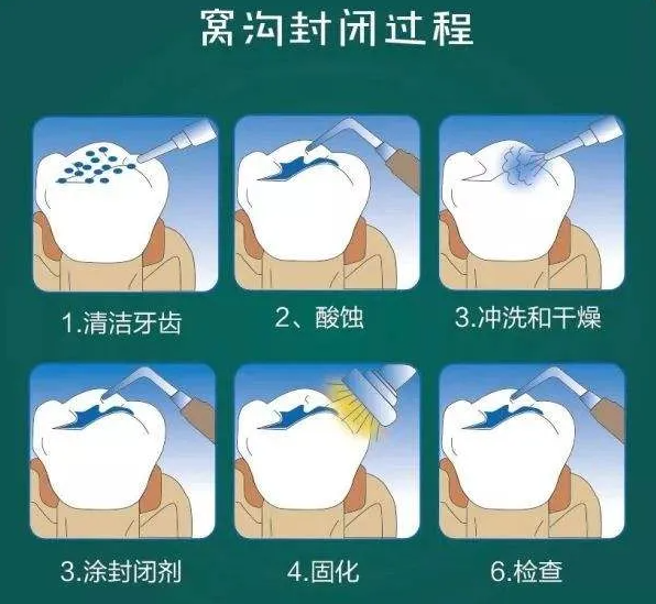 价格、材质与持久性，孩子需注意的关键细节