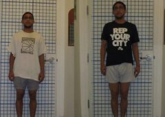 身材美观的追求：深度了解增高手术，权衡利弊谨慎选择