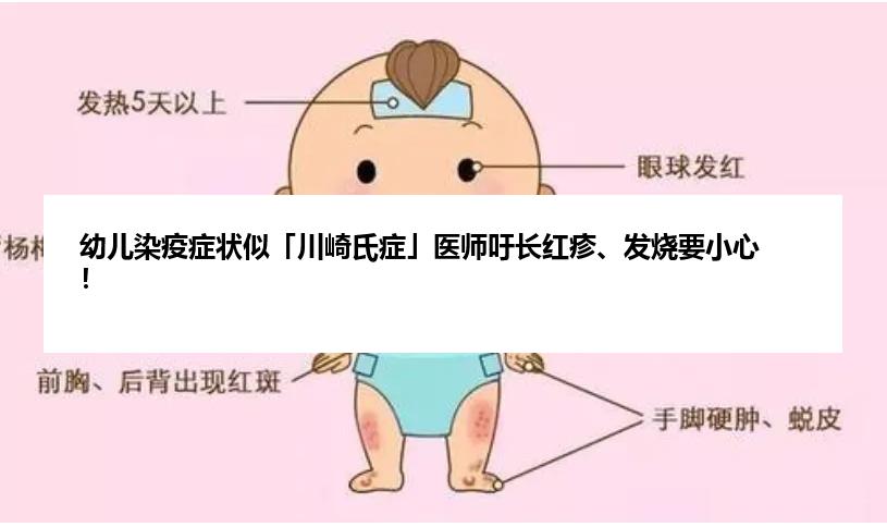 幼儿染疫症状似「川崎氏症」医师吁长红疹、发烧要小心！