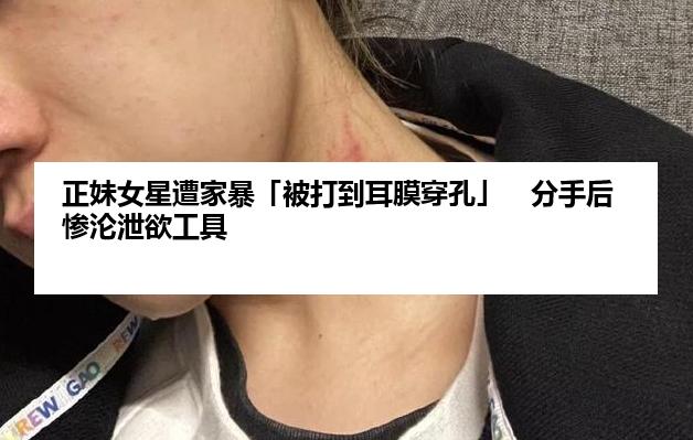 正妹女星遭家暴「被打到耳膜穿孔」　分手后惨沦泄欲工具